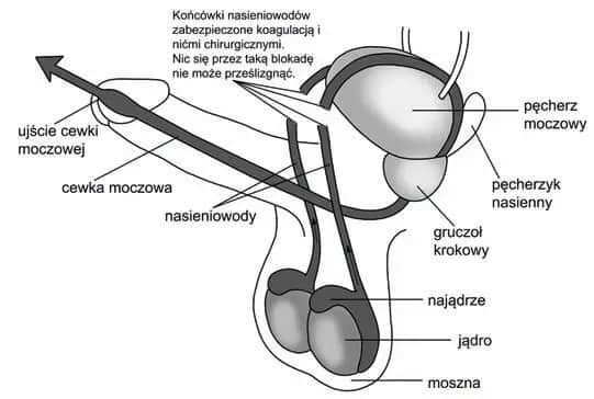 Czy wazektomia to grzech? Moralne dylematy i nauka Kościoła