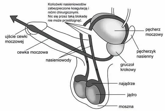 Czy wazektomia to grzech? Moralne dylematy i nauka Kościoła